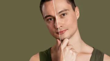 Non-surgical skin treatments in Chennai